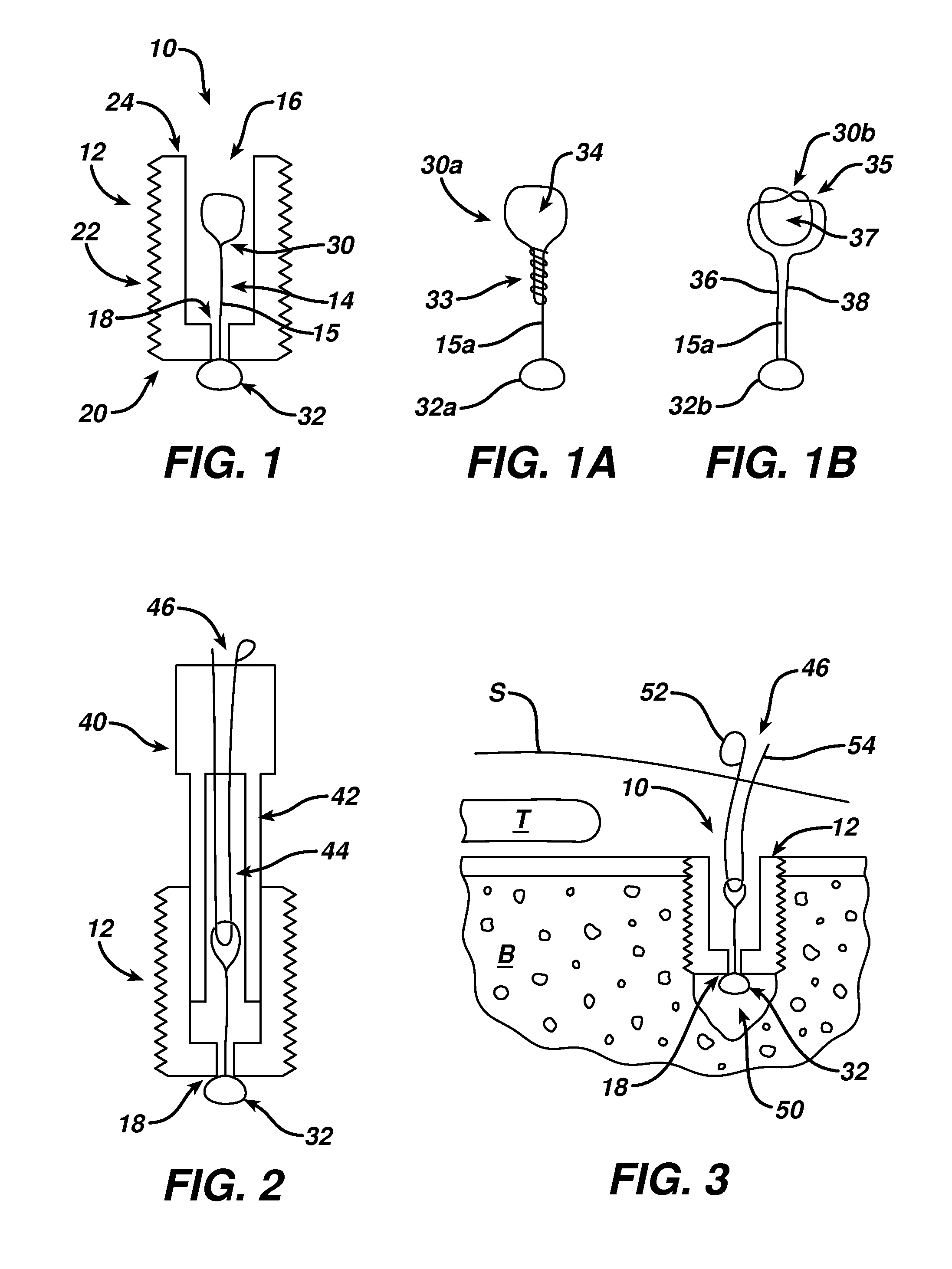 Surgical filament snare assemblies