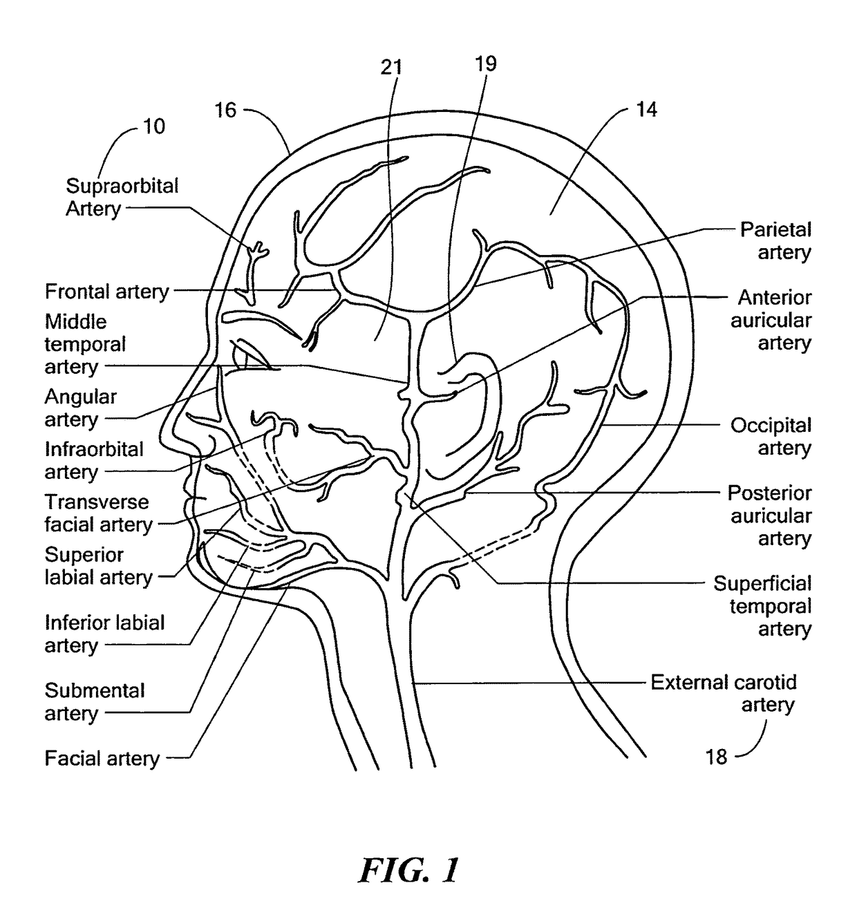 Non-invasive intracranial pressure monitoring system and method thereof