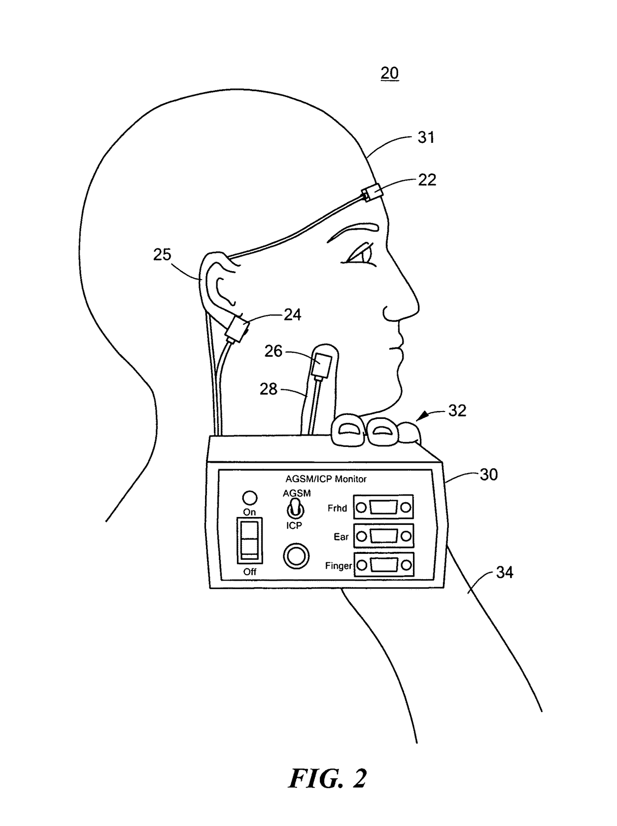 Non-invasive intracranial pressure monitoring system and method thereof