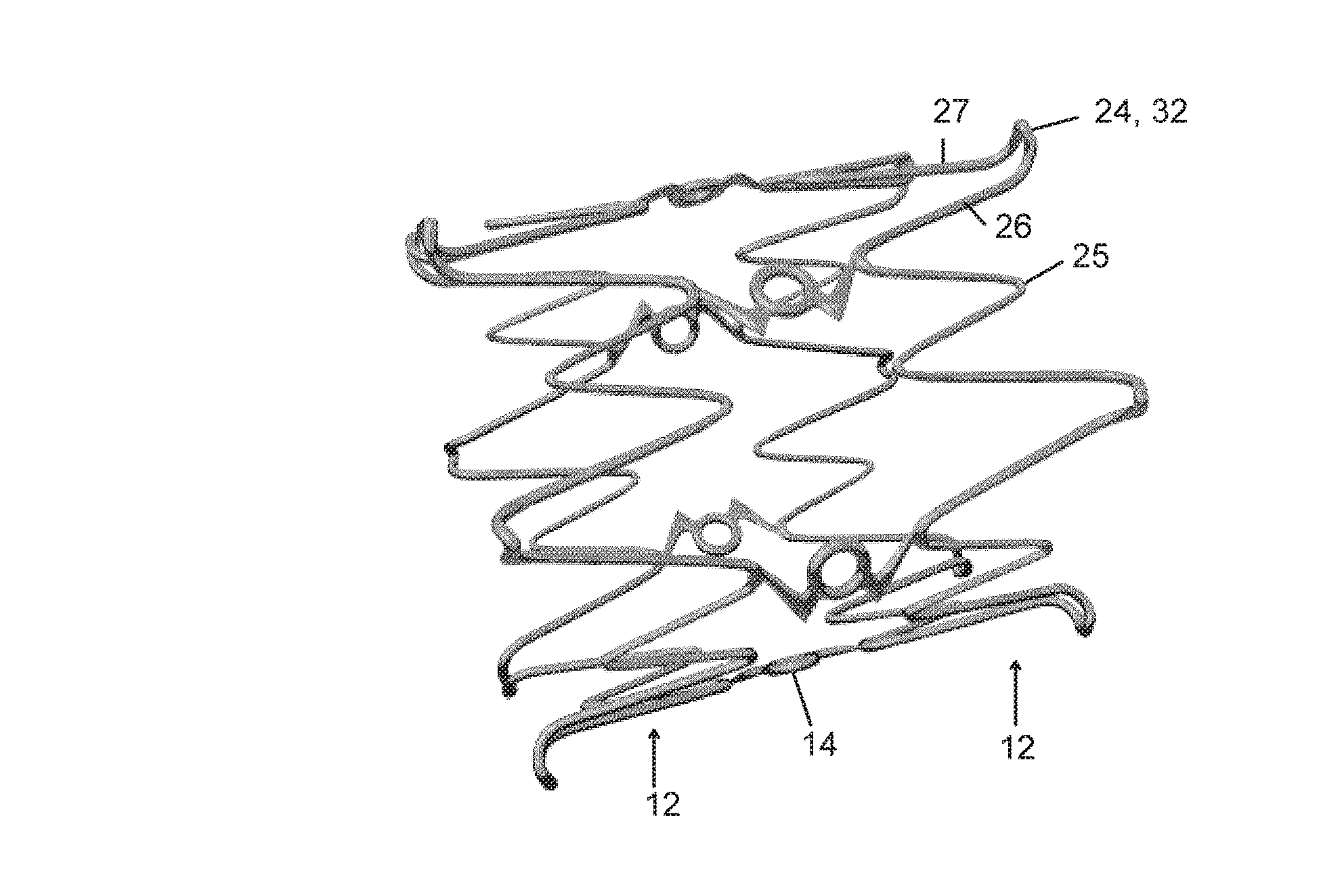 Endovascular implant