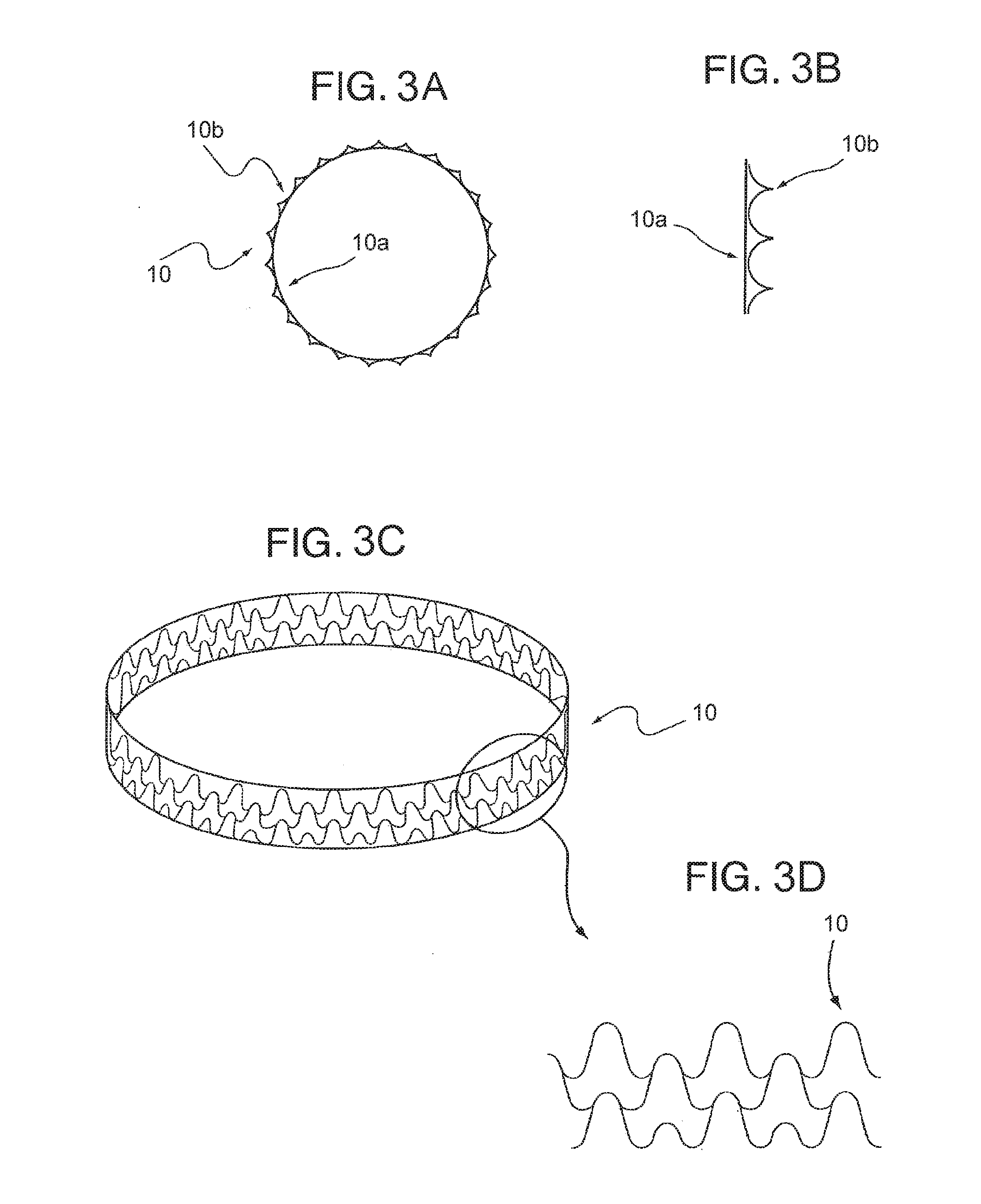 Endovascular implant