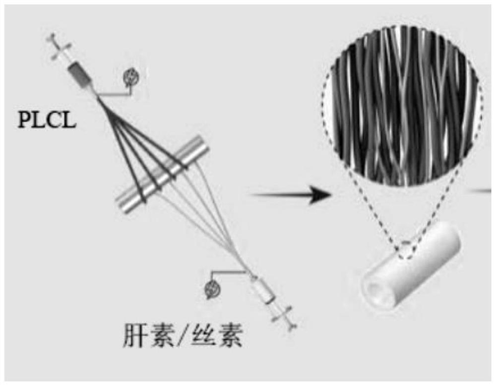 Preparation method of conjugate electrospinning nanofiber artificial small-caliber intravascular stent and product