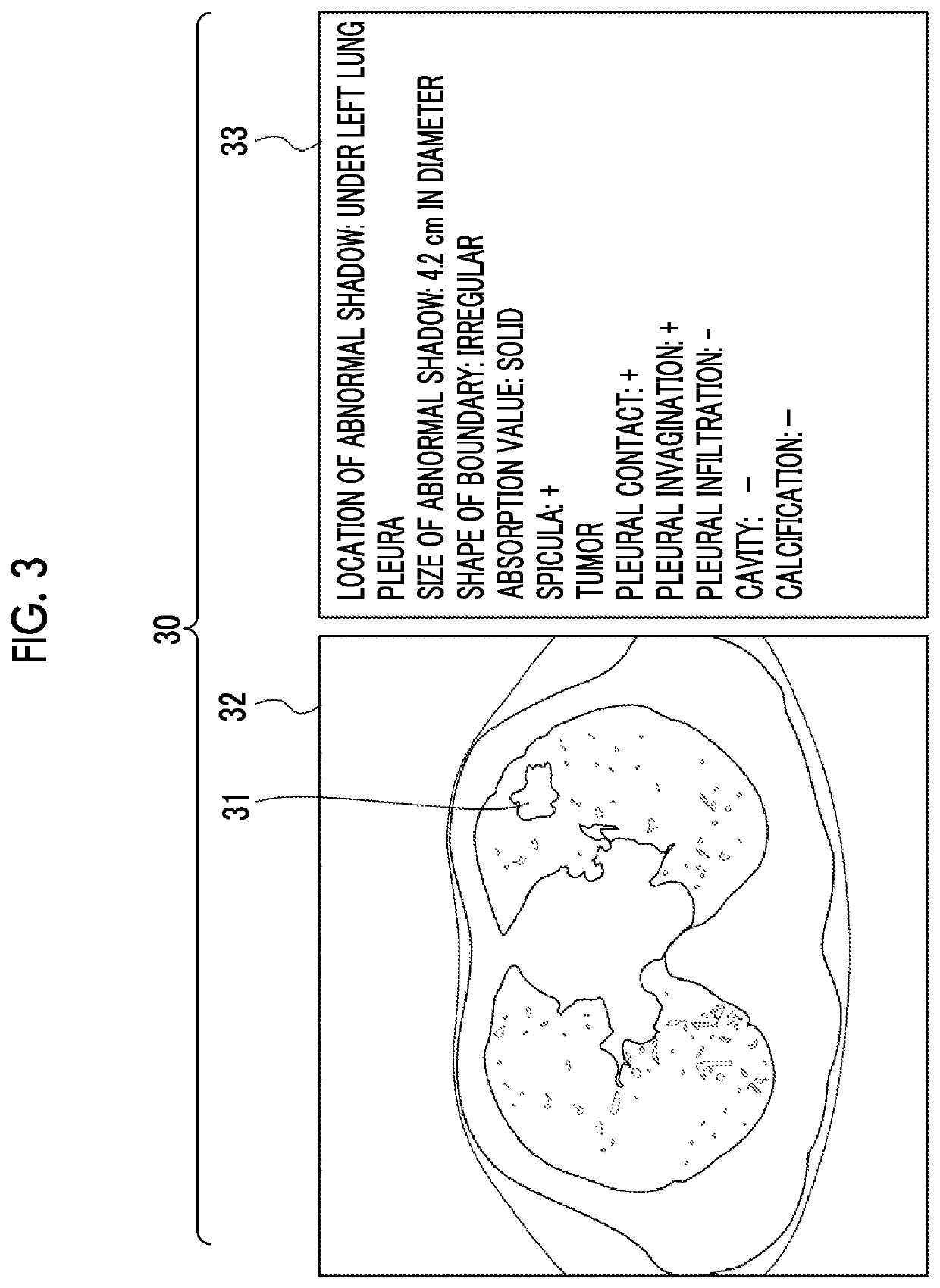 Document creation support apparatus, method, and program