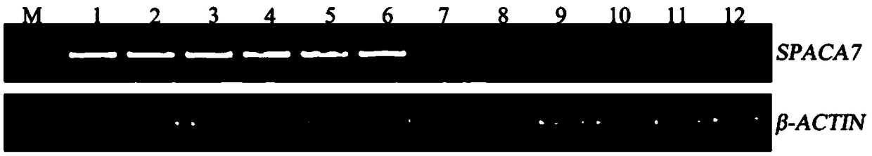 Application of SPACA7 gene