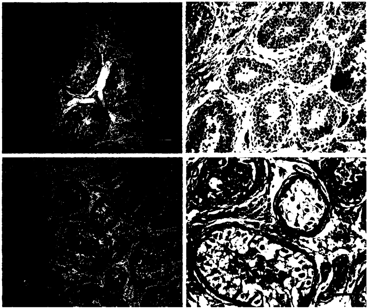 Application of SPACA7 gene