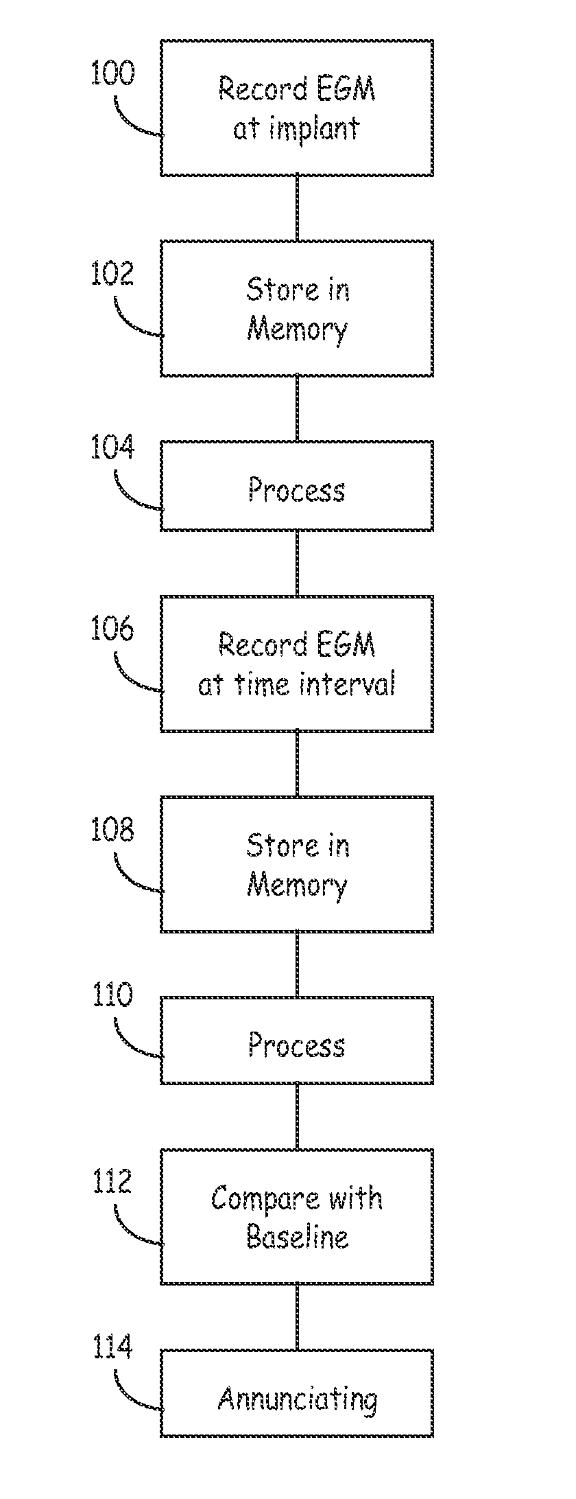 Method and apparatus for detecting left ventricular lead displacement based upon EGM change