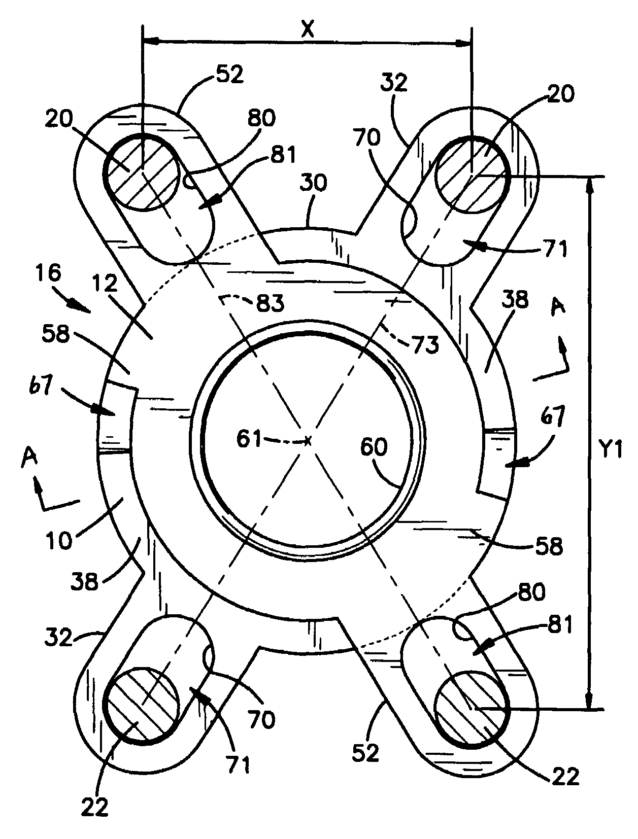 Translational scissor plate fixation system