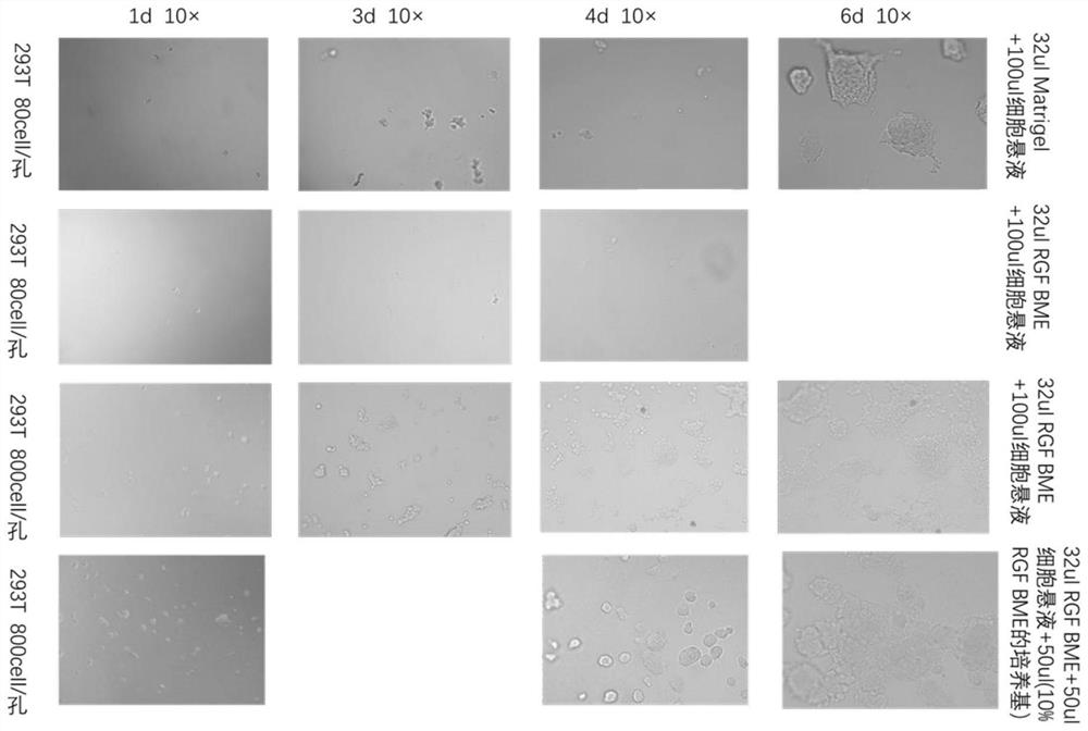 Organoid culture system and organoid culture method