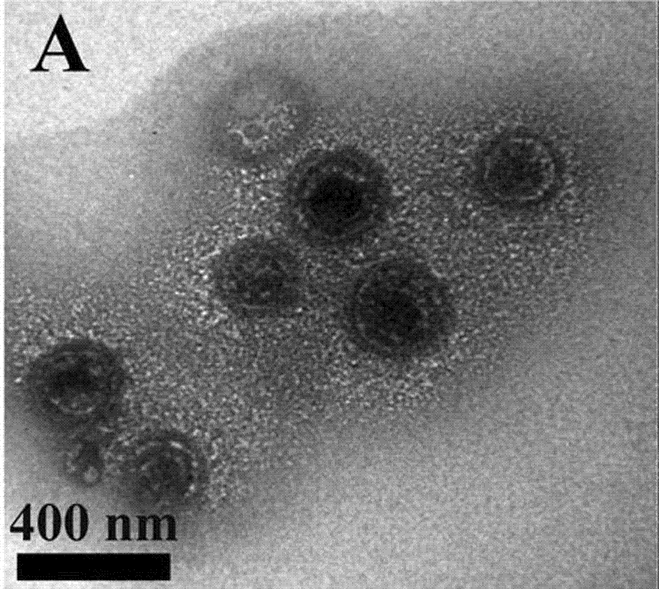 Prussian blue-loaded targeting nanocomposite and preparation method thereof