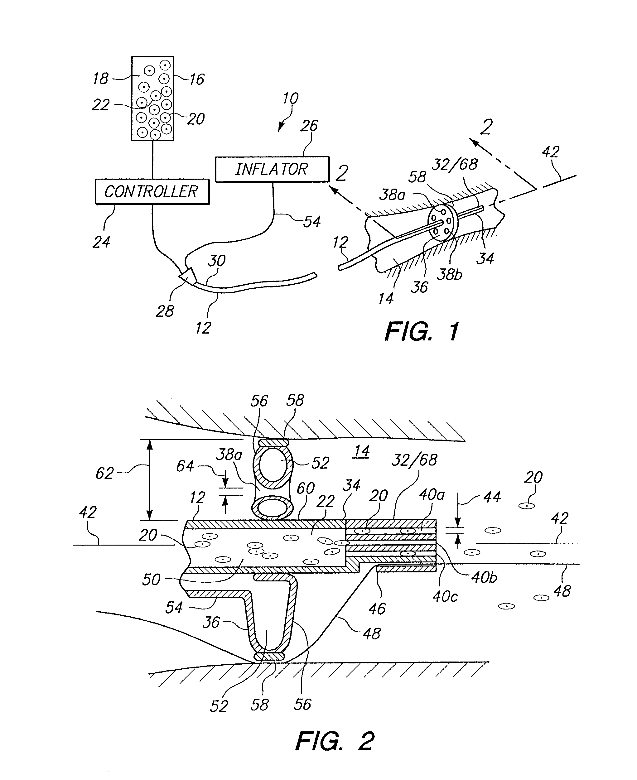 Method for infusing stem cells