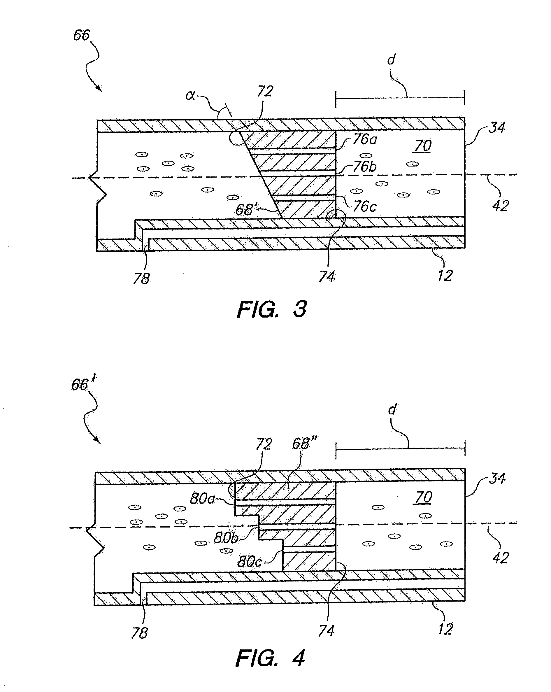 Method for infusing stem cells