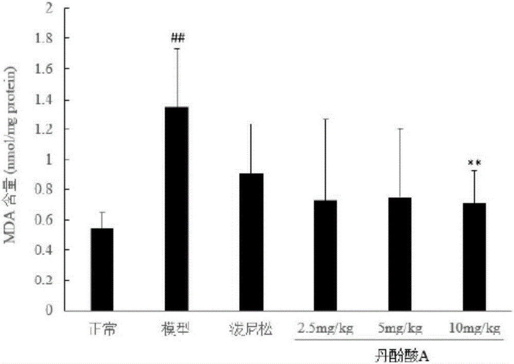 Application of salvianolic acid a alone or in combination with multiple drugs in the preparation of medicines for treating nephrotic syndrome