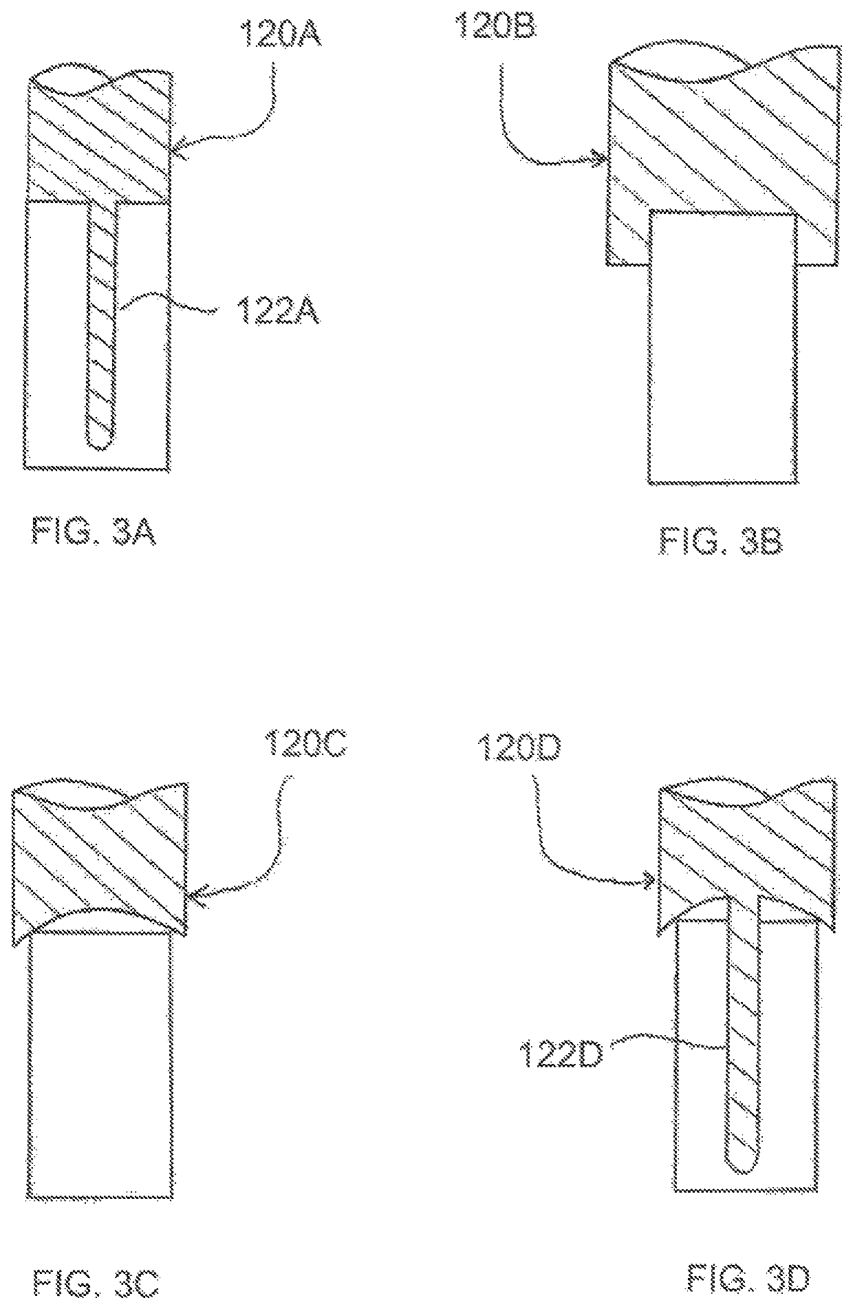 Method and devices for intracorporeal bonding of implants with thermal energy