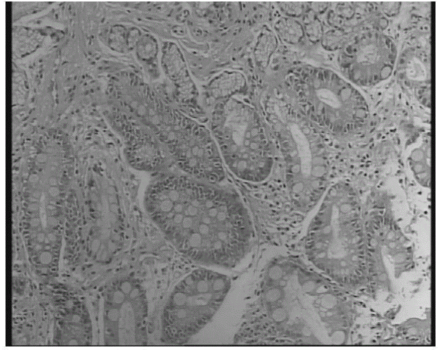 Traditional Chinese medicinal compound composition and preparation for treating chronic atrophic gastritis and precancerous lesion as well as preparation method of traditional Chinese medicinal compound composition