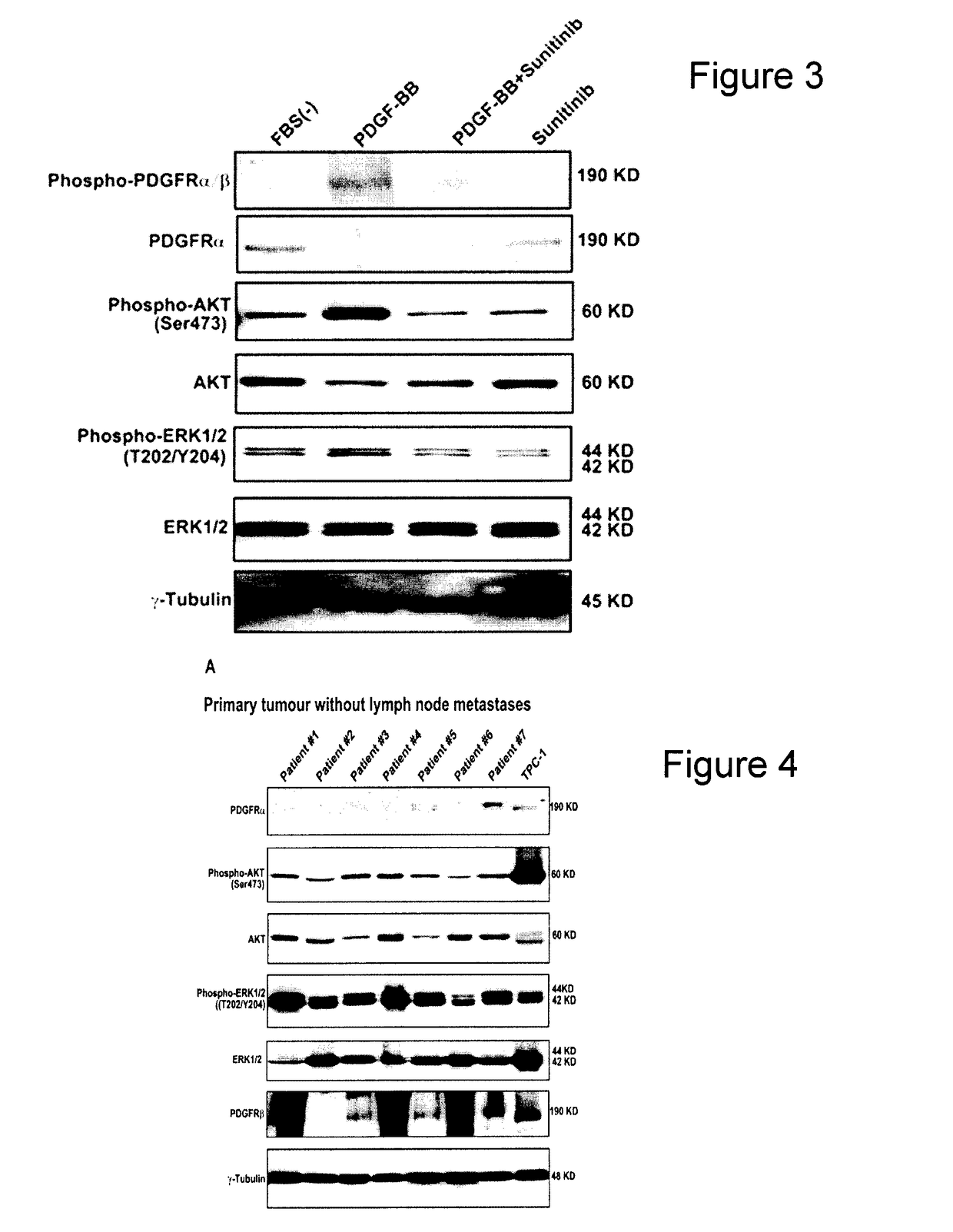 Methods, kits, and systems for treatment of metastatic papillary thyroid cancer