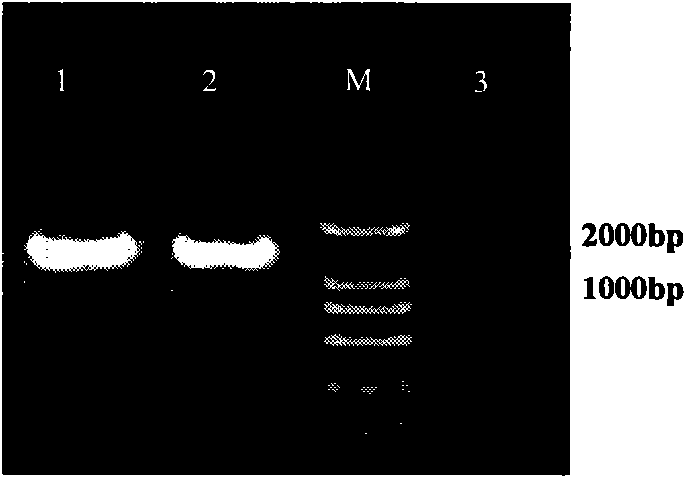 Lactobacillus plantarum strain and application thereof