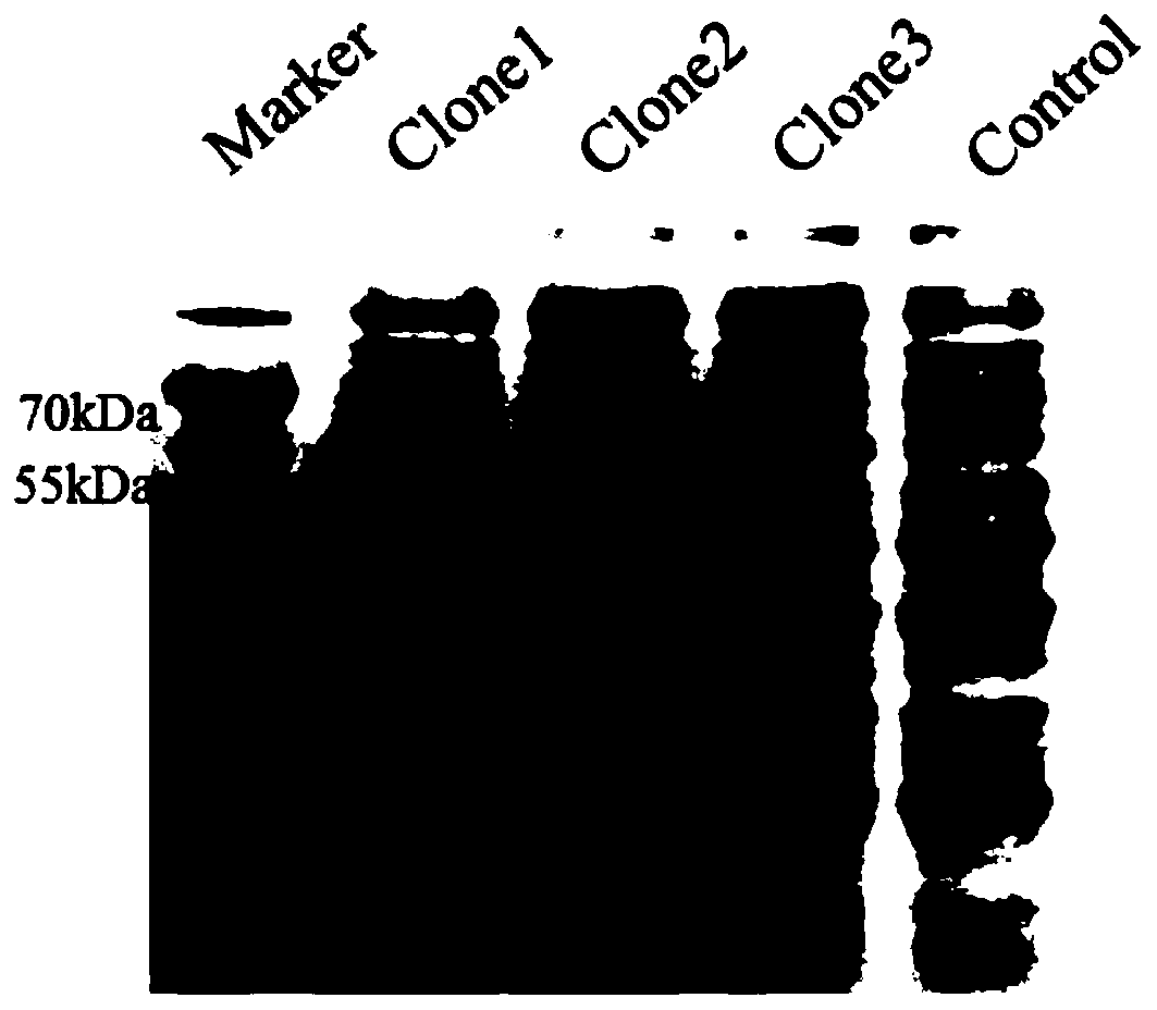 Cell-penetrating peptide-pre-B cell leukemia transcription factor 1 fusion protein and preparation method and application thereof