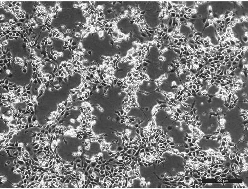 Largemouth bass iridovirus disease inactivated vaccine and preparation method thereof