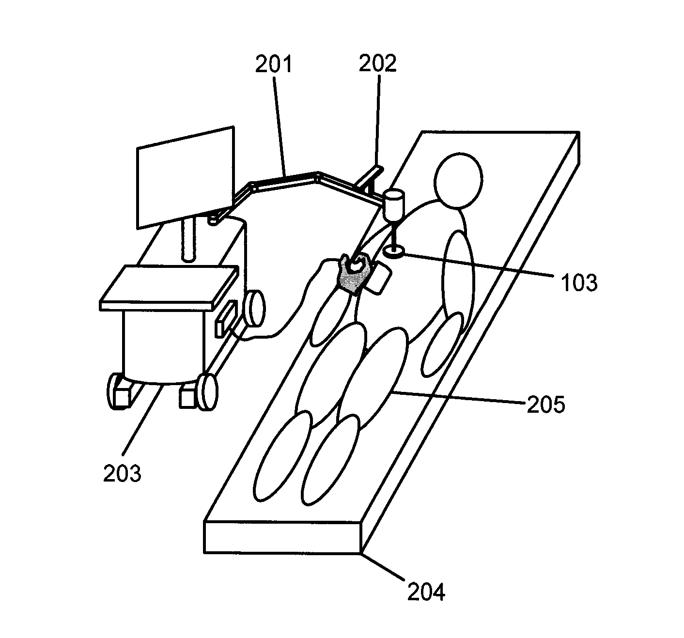 Elastography Using Ultrasound Imaging of a Thin Volume