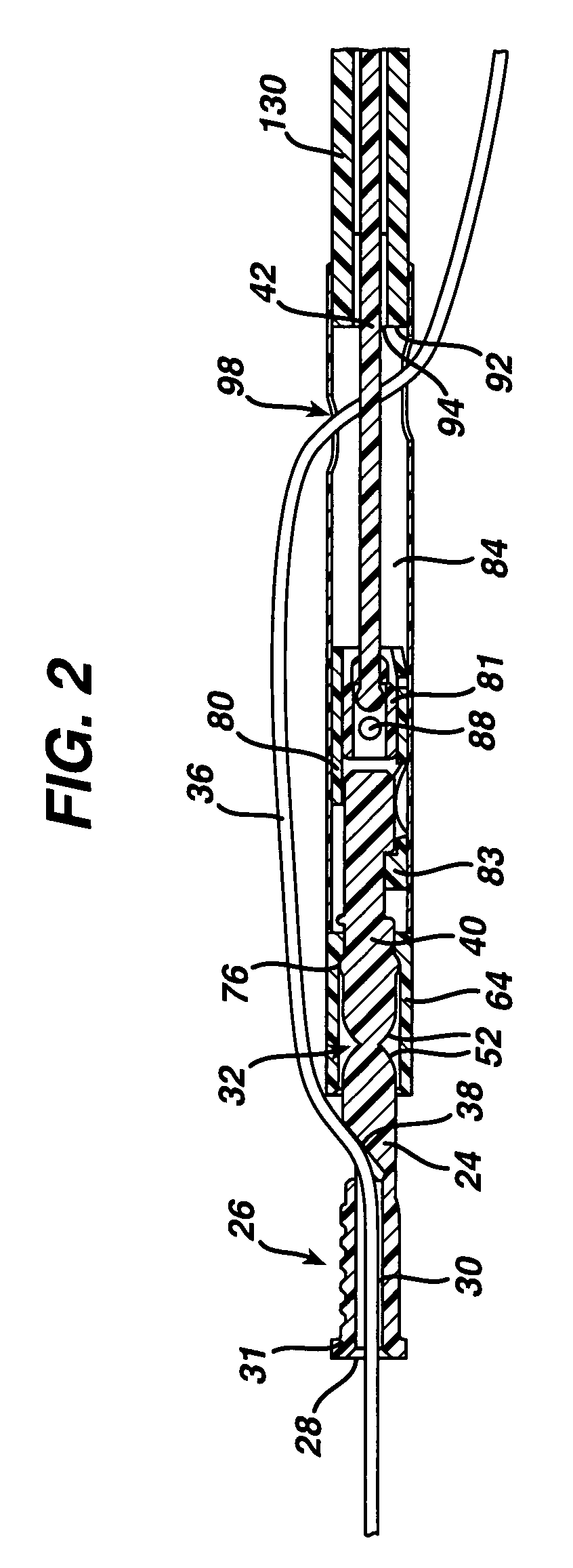 Suture locking method