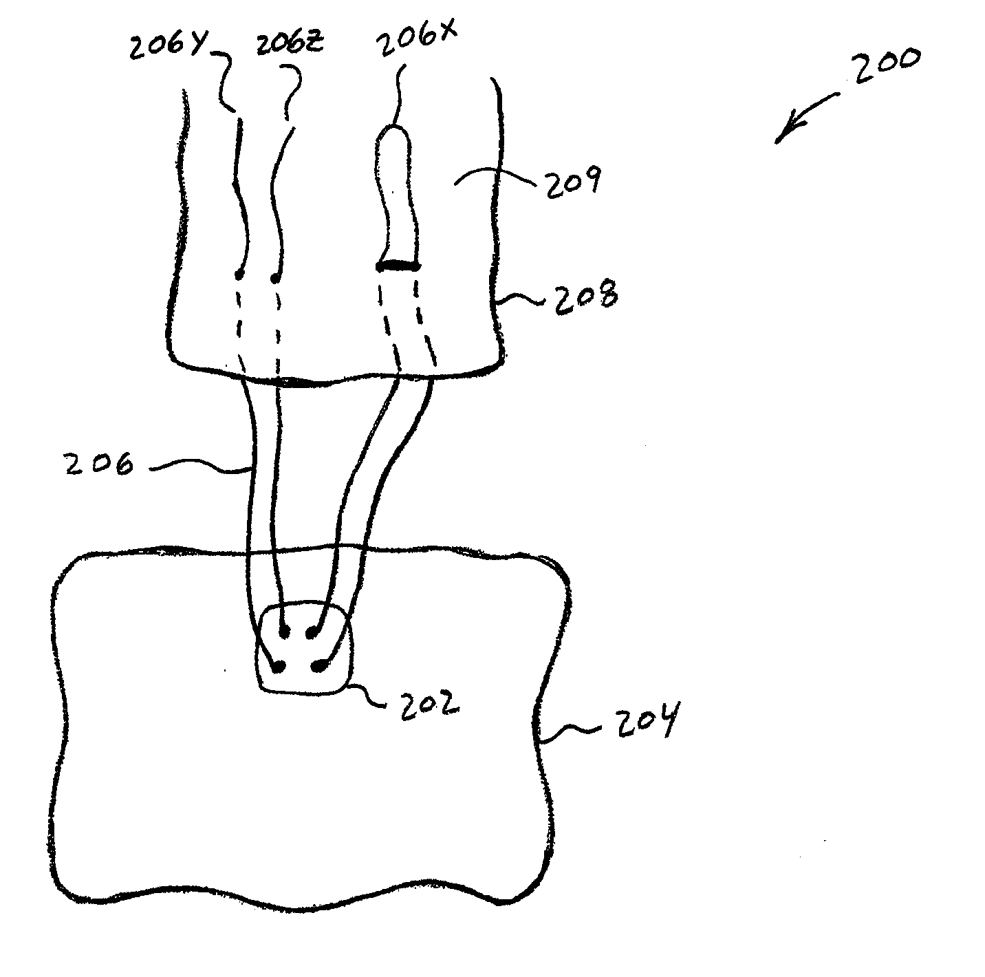 Soft Tissue Fixation Using A Looped Suture Construct