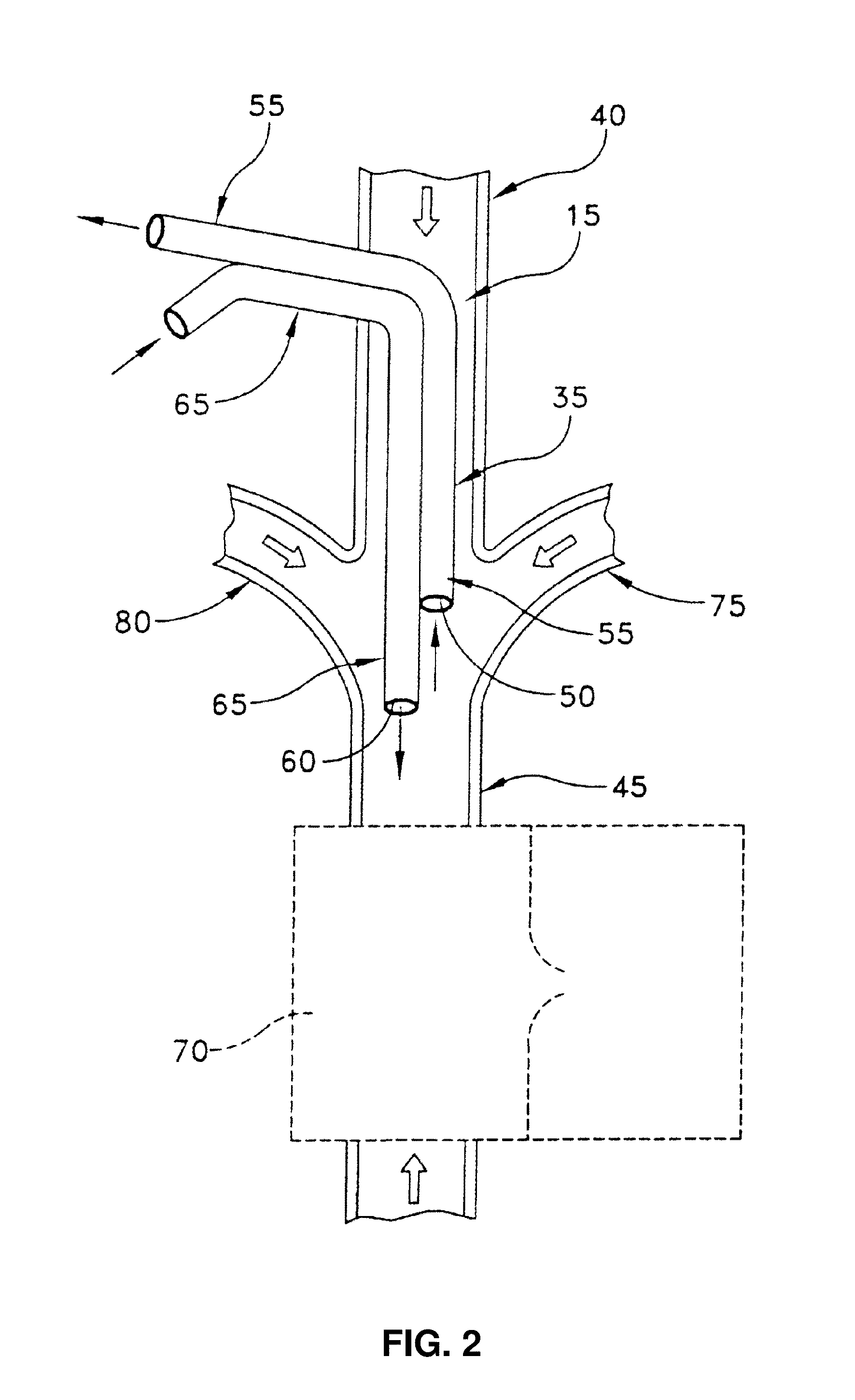 Method and apparatus for the dialysis of blood