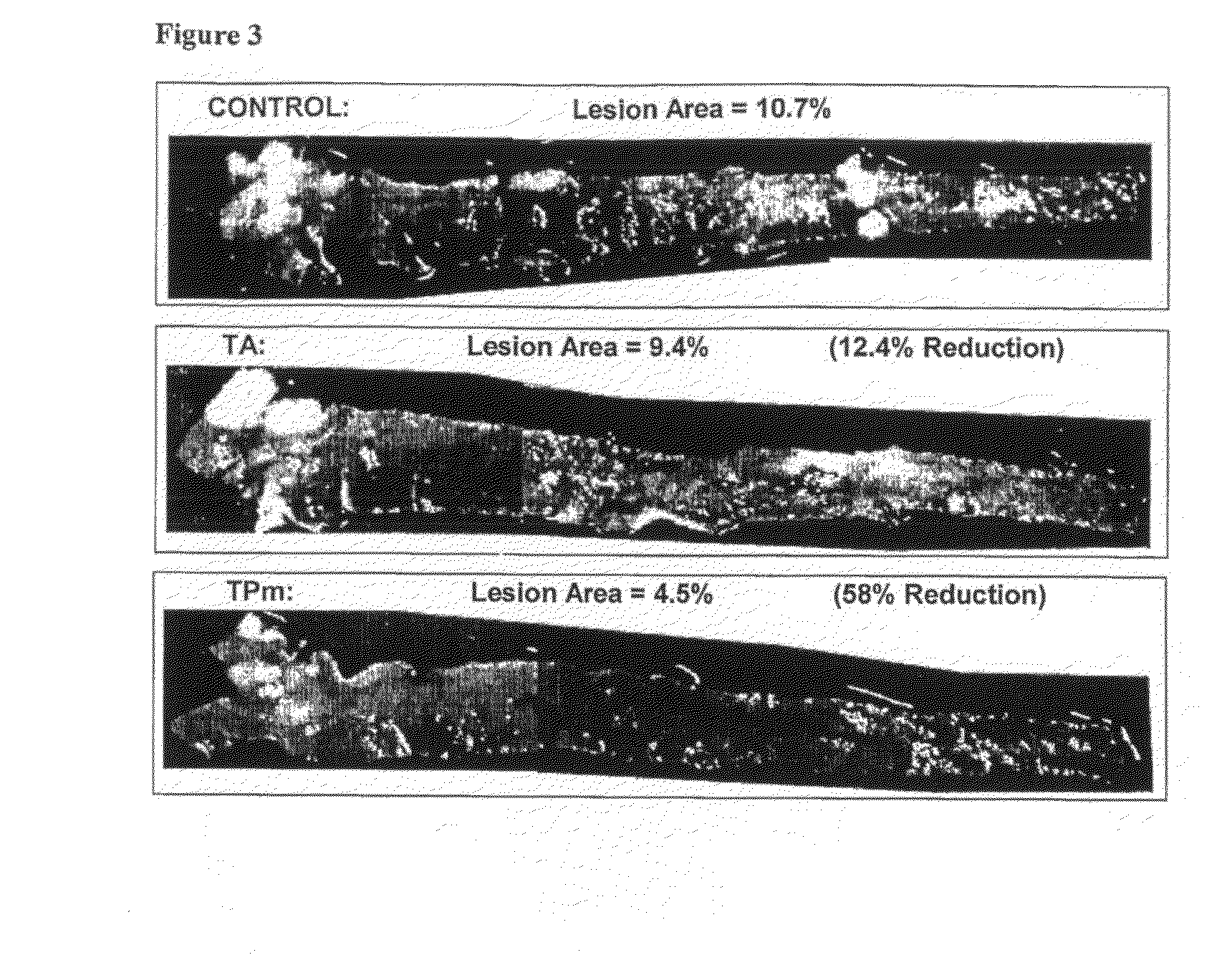 Compounds having lipid lowering properties