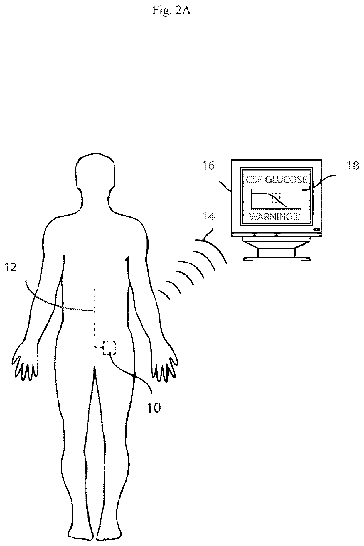 Systems and methods for lumbar cerebrospinal fluid access and treatment