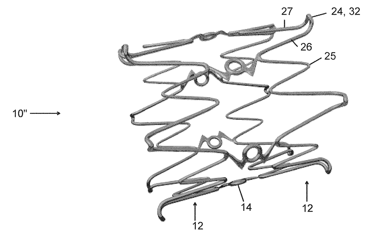 Endovascular implant