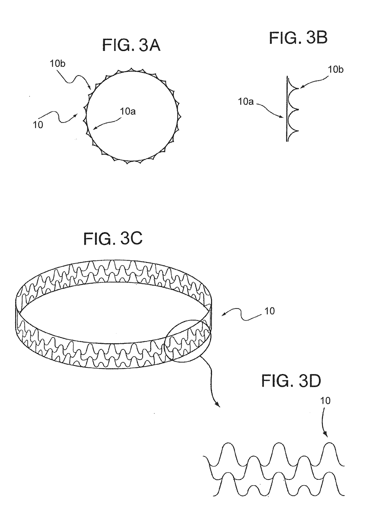 Endovascular implant