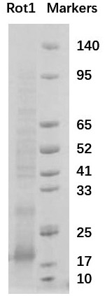 Nanometer antibody targeting rotavirus protein and application thereof