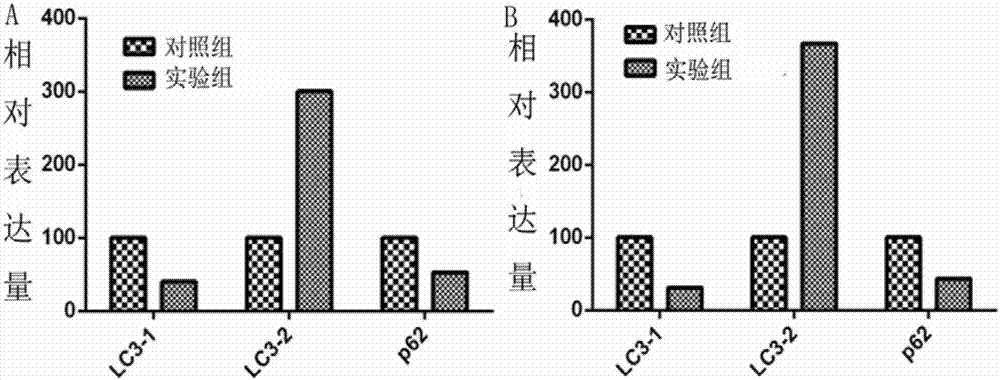 Microarray chip for detecting protein expression in cell stress reaction and its preparation method, kit and detection method