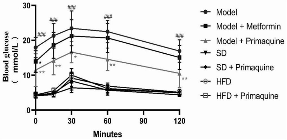 Application of quinoline derivative in preparation of medicine for treating diabetes and complications thereof