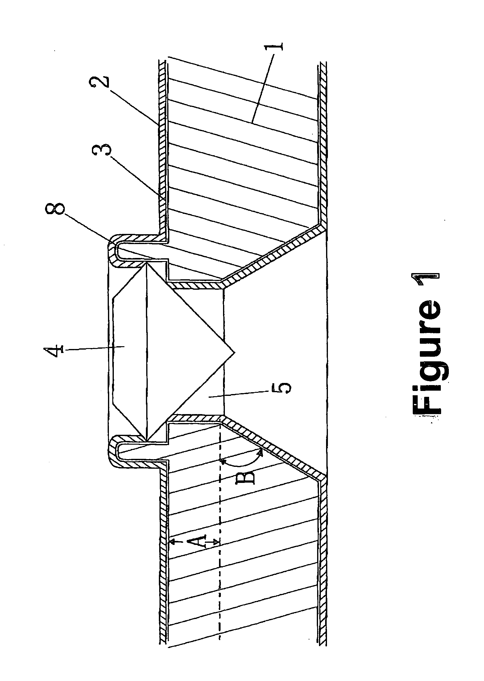 Setting stones in the surface of electroformed piece