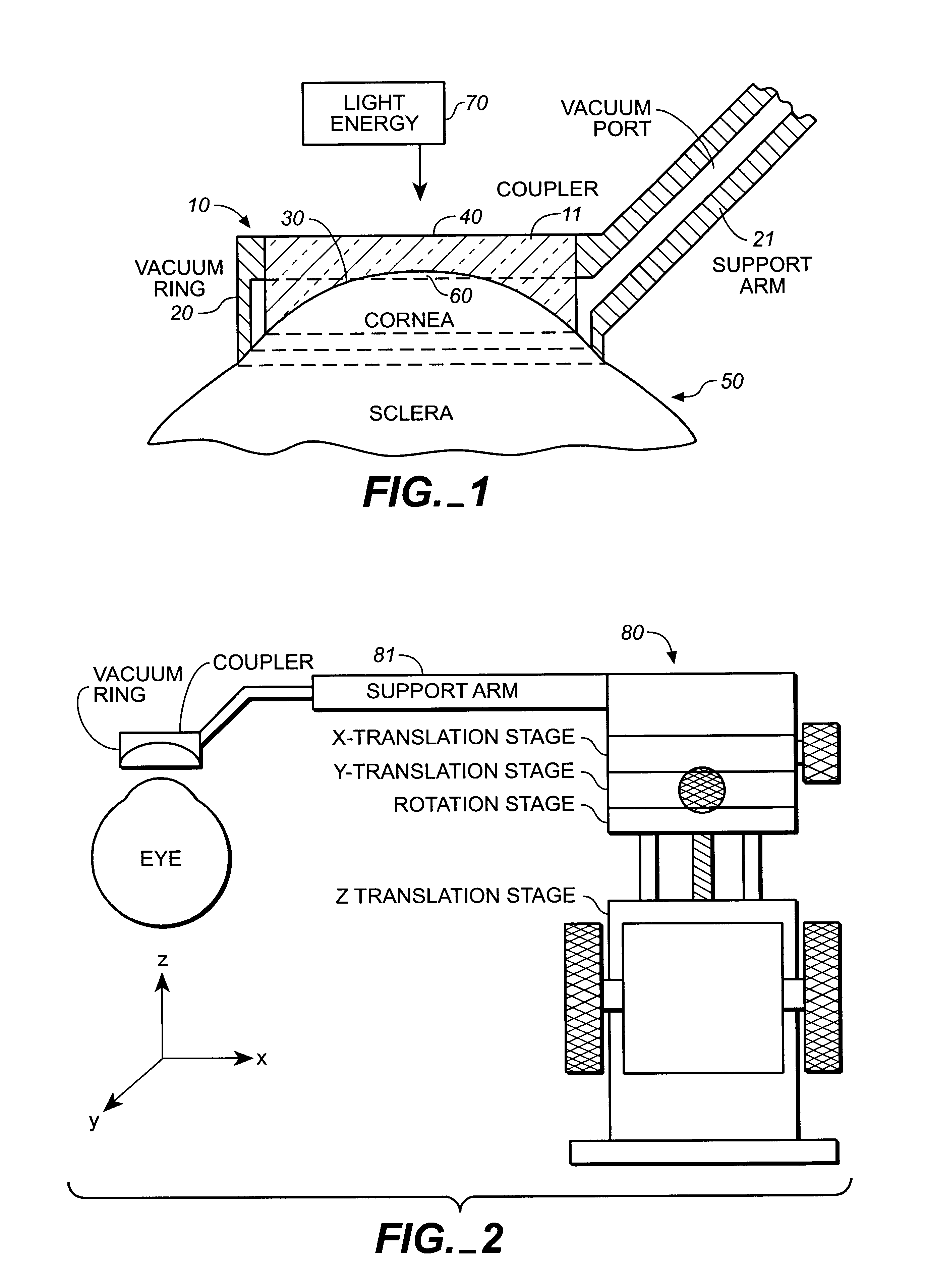 Apparatus for cornea reshaping