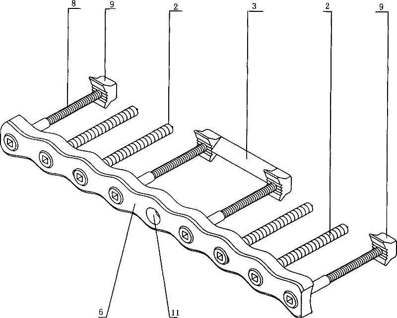 Locking steel plate and collimation assembly component thereof