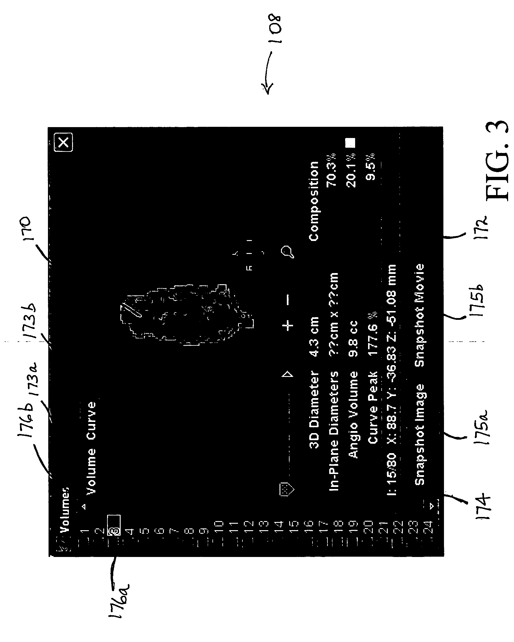 Apparatus and method for surgical planning and treatment monitoring