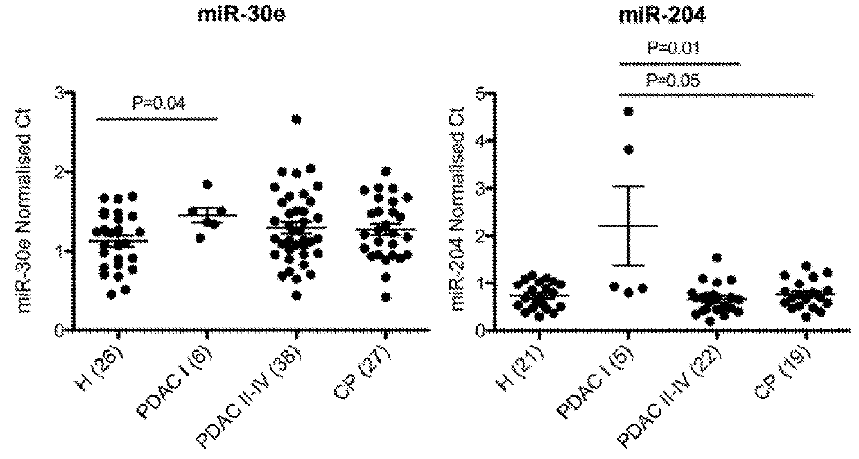 Novel biomarkers for pancreatic diseases