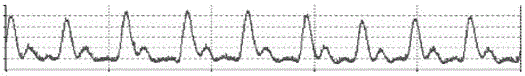 Non-invasive blood pressure detection method based on mixing of photoelectric green-light pulses and electrocardiogram