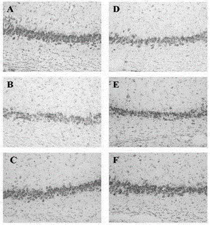 Pharmaceutical composition for treating alzheimer disease