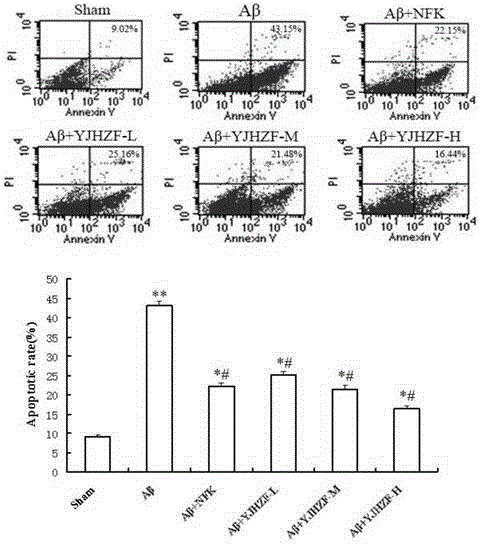 Pharmaceutical composition for treating alzheimer disease