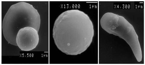 A method for blood cell collection and ultrastructural observation of sea mussels