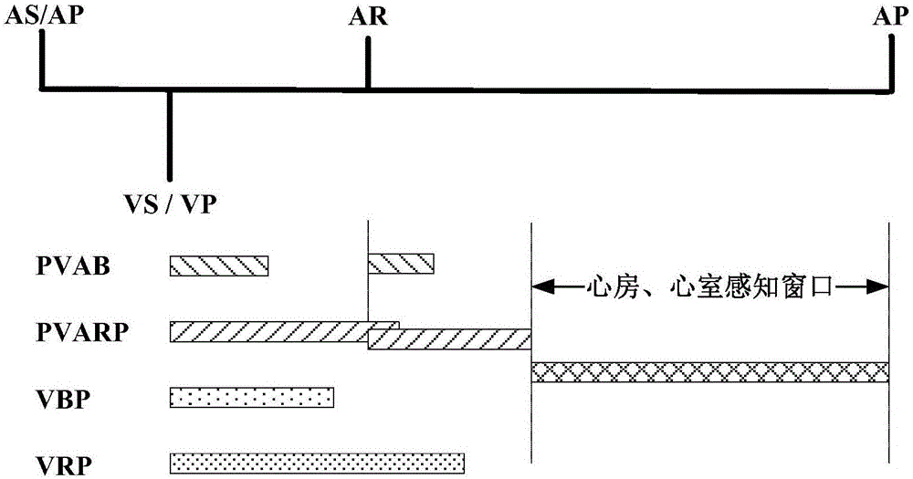 Method for eliminating atrial far-field signals in ventricular channels for implantable cardiac pacemaker