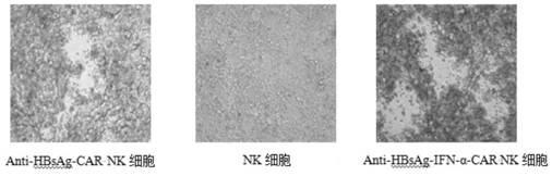 Chimeric antigen receptor, its preparation method, nk cell modified by using it and its application in treating hbv infection