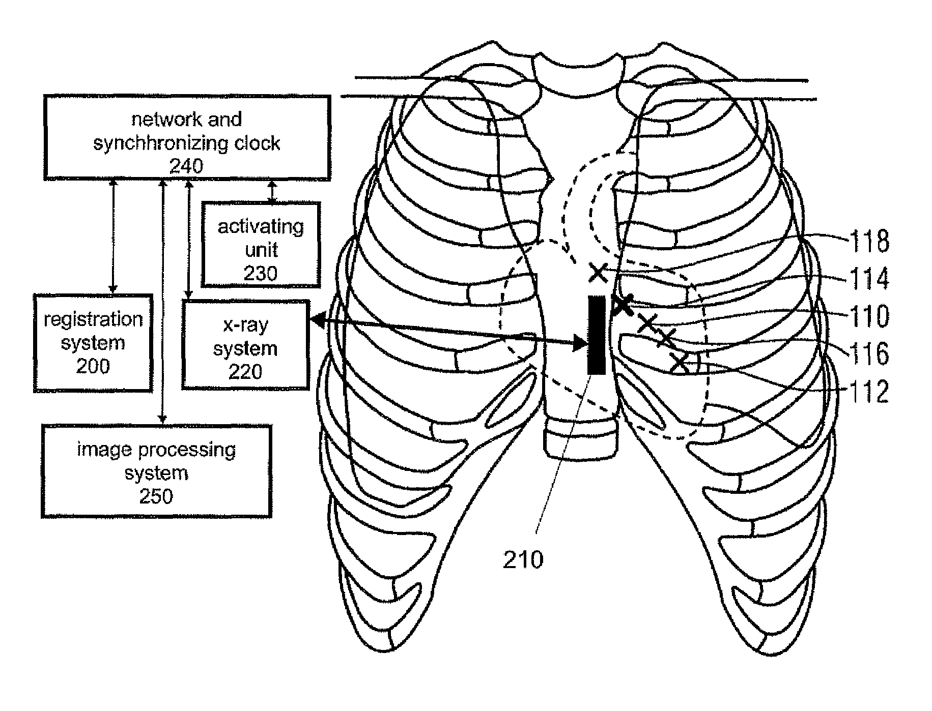 Method and system for concurrent localization and display of a surgical catheter and local electrophysiological potential curves