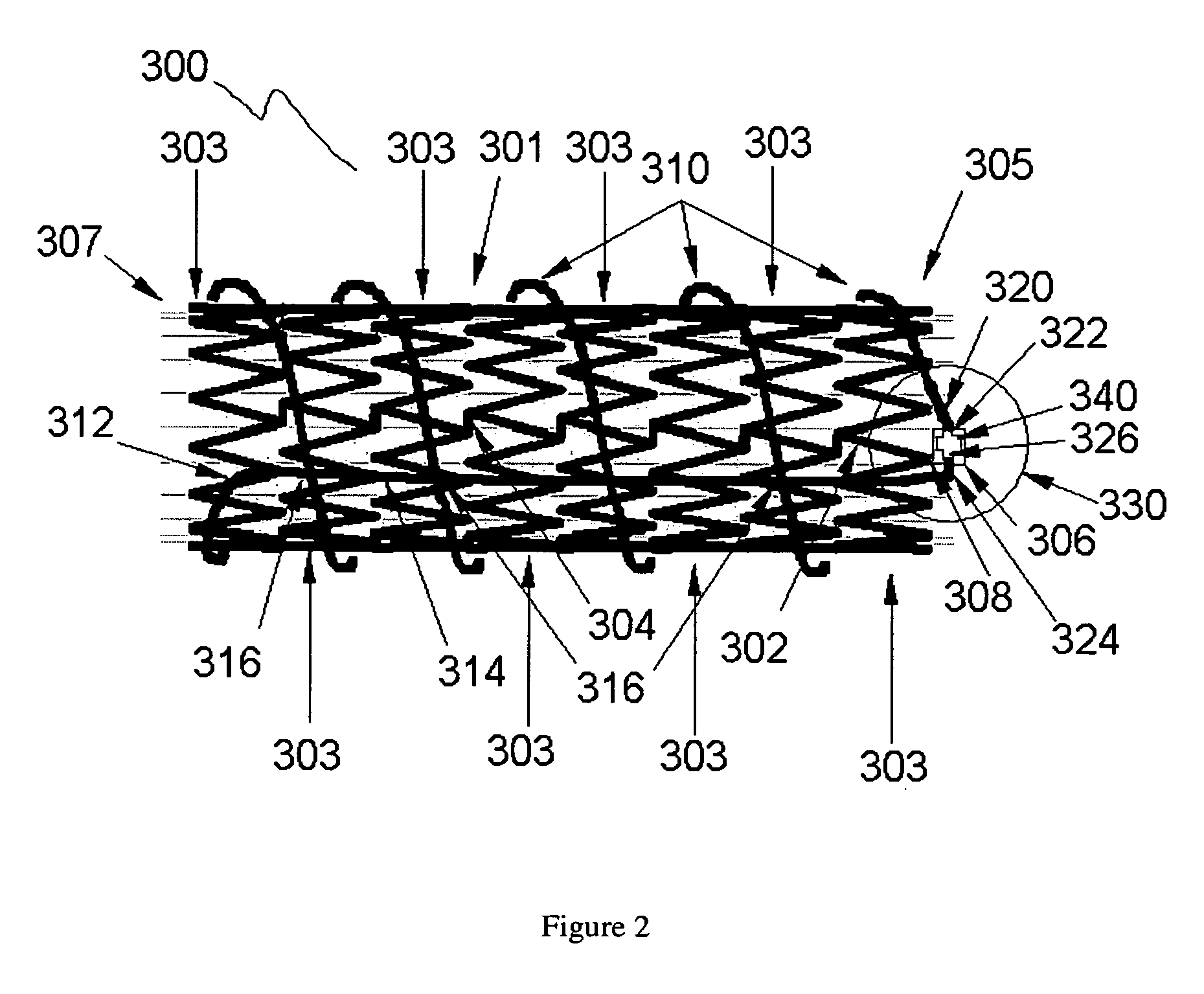 Stent and MR imaging process and device