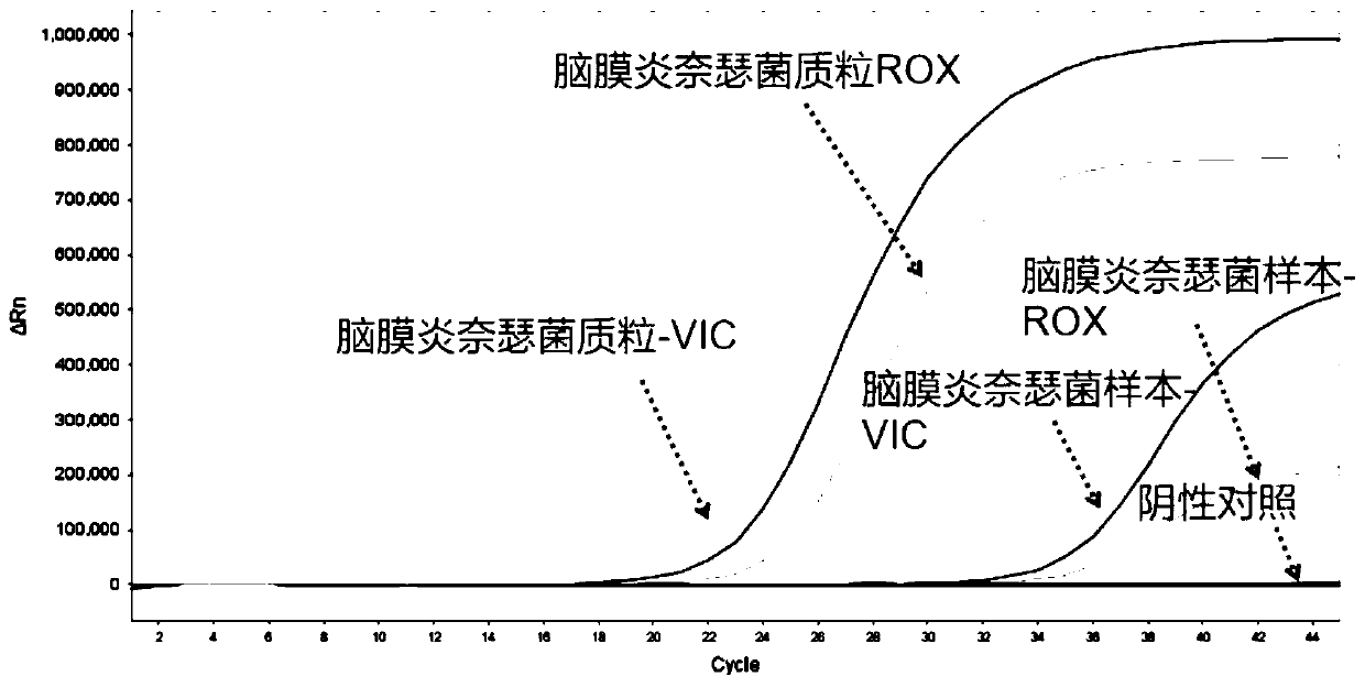 Nucleic acid typing detection kit for encephalitis and meningitis and detection method