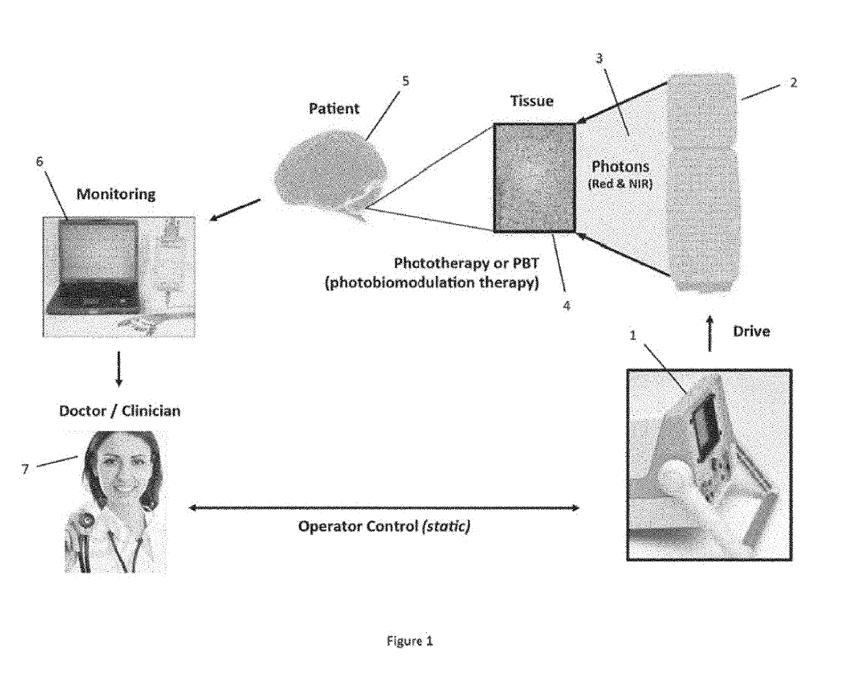 Distributed Photobiomodulation Therapy Devices And Methods, Biofeedback, And Communication Protocols Therefor