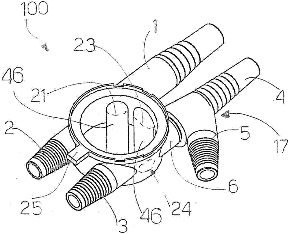 Fluid flow switching device for catheterization with a three way bladder catheter