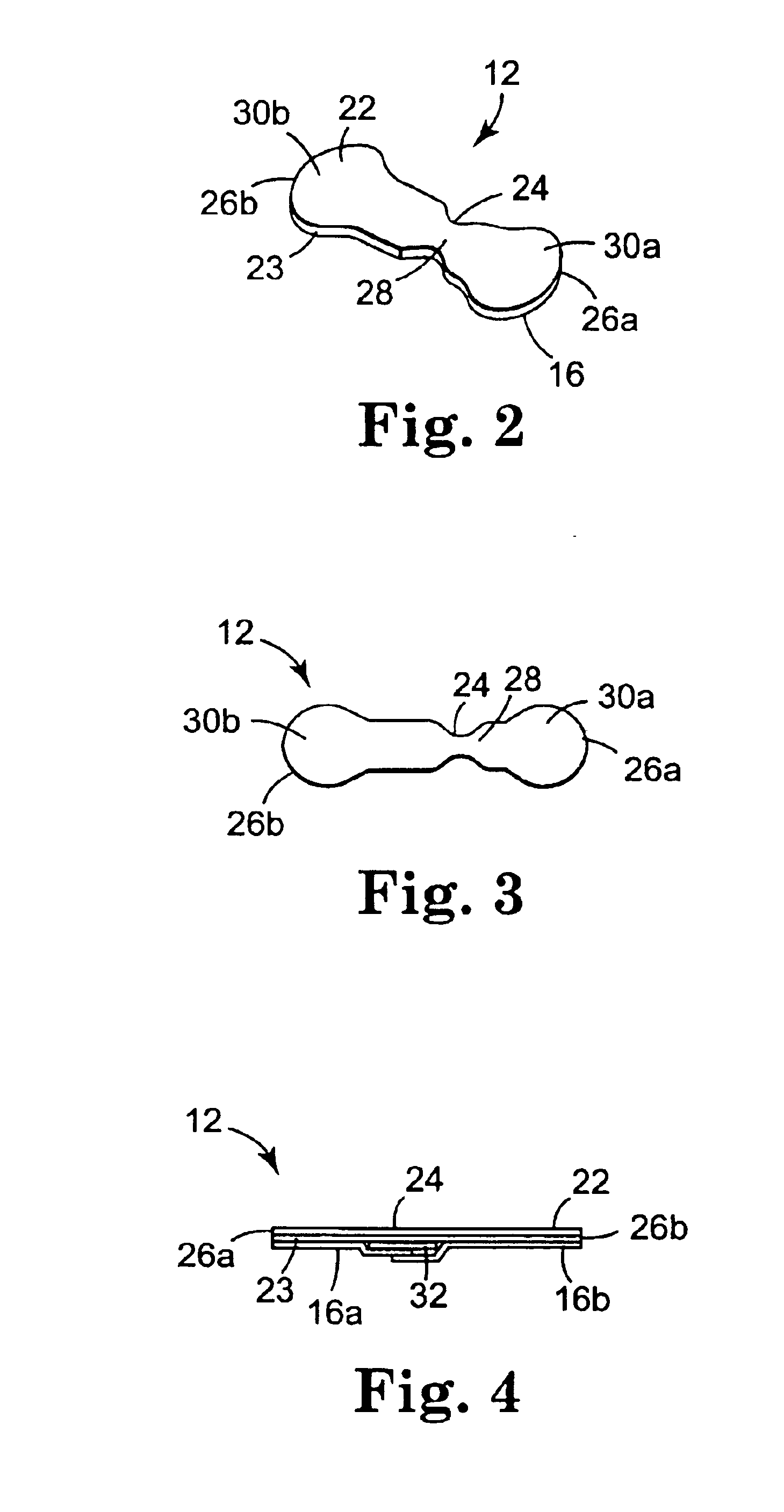 Wound closure system and method